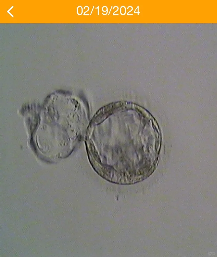 🇺🇸IVF 试管 记录时间线3 - 移植周期