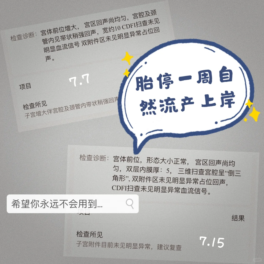 胎停一周内自然流产成功上岸经验